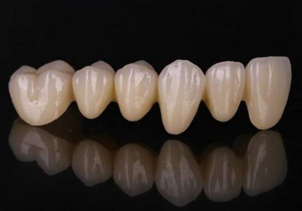 3D打印陶瓷義齒